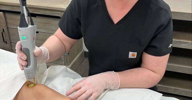 Toe Nail Fungus Removal